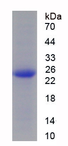 Recombinant Succinate Dehydrogenase Complex Subunit B (SDHB)