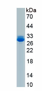 Recombinant Cbp/p300 Interacting Transactivator, With Glu/Asp Rich Carboxy Terminal Domain 1 (CITED1)