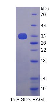 Recombinant Tyrosine 3/Tryptophan 5 Monooxygenase Activation Protein Theta (YWHAq)