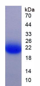 Recombinant Tyrosine 3/Tryptophan 5 Monooxygenase Activation Protein Zeta (YWHAz)