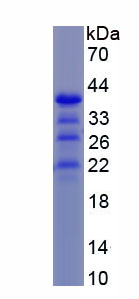 Recombinant Zinc Finger Homeobox Protein 1B (ZFHX1B)