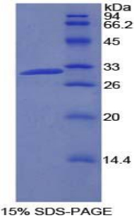 Recombinant Phosphoinositide-3-Kinase Class-2-Beta Polypeptide (PIK3C2b)