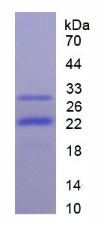 Recombinant Phosphoinositide-3-Kinase Catalytic Beta Polypeptide (PIK3Cb)