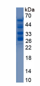 Recombinant Retinoschisin (RS)