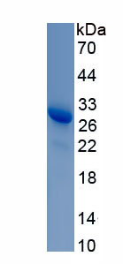 Recombinant Retinoschisin (RS)