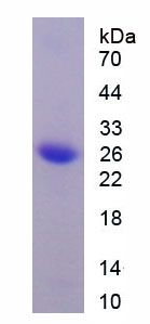 Recombinant Coiled Coil Domain Containing Protein 80 (CCDC80)