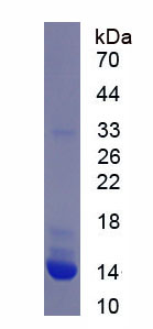 Recombinant V-Set Domain Containing T-Cell Activation Inhibitor 1 (VTCN1)