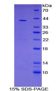 Recombinant V-Set Domain Containing T-Cell Activation Inhibitor 1 (VTCN1)