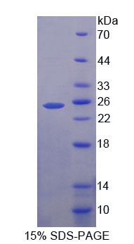 Recombinant Enhancer Of Zeste Homolog 1 (EZH1)