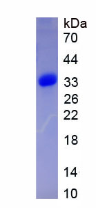 Recombinant Enhancer Of Zeste Homolog 2 (EZH2)