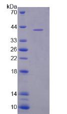 Recombinant NLR Family, Pyrin Domain Containing Protein 3 (NLRP3)