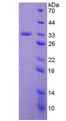 Recombinant A Disintegrin And Metalloprotease 28 (ADAM28)