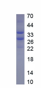 Recombinant A Disintegrin And Metalloproteinase With Thrombospondin 4 (ADAMTS4)