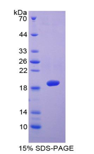 Recombinant A Disintegrin And Metalloproteinase With Thrombospondin 5 (ADAMTS5)