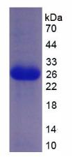 Recombinant Patched Homolog 1 (PTCH1)