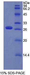 Recombinant Patched Homolog 1 (PTCH1)