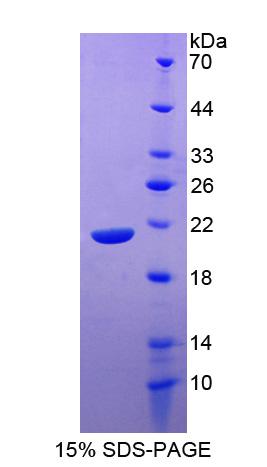 Recombinant Signaling Lymphocytic Activation Molecule Family, Member 7 (SLAMF7)