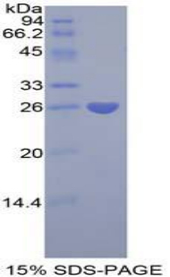 Recombinant Pentraxin 3, Long (PTX3)