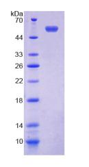 Recombinant Transmembrane Protein 27 (TMEM27)