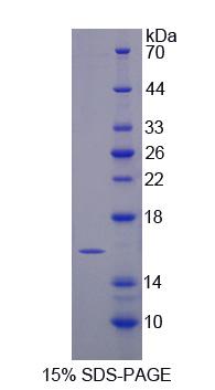 Recombinant Transmembrane Protein 27 (TMEM27)