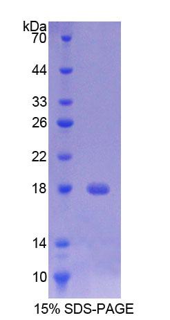 Recombinant Transmembrane Protein 27 (TMEM27)