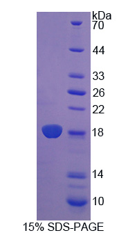 Recombinant Regenerating Islet Derived Protein 3 Beta (REG3b)