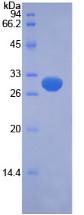 Recombinant PTEN Induced Putative Kinase 1 (PINK1)