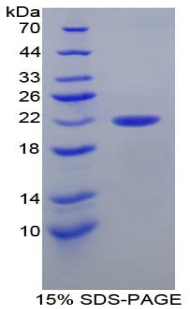 Recombinant Parkinson Disease Protein 7 (PARK7)