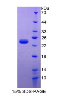 Recombinant Parkinson Disease Protein 7 (PARK7)