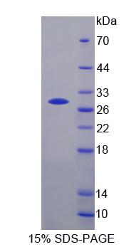 Recombinant Parkinson Disease Protein 2 (PARK2)