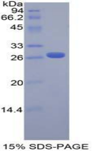 Recombinant Fibroblast Growth Factor Receptor Like Protein 1 (FGFRL1)