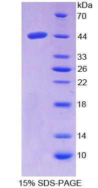 Recombinant Niemann Pick Disease Type C2 (NPC2)