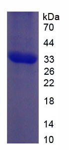 Recombinant Notch Homolog 2 (NOTCH2)