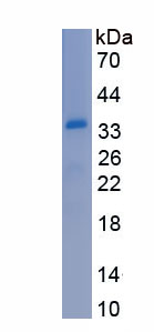 Recombinant Notch Homolog 2 (NOTCH2)