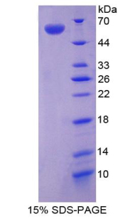 Recombinant Angiogenic Factor With G Patch And FHA Domains 1 (AGGF1)