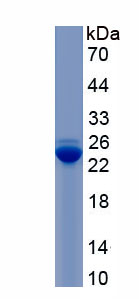 Recombinant Autophagy Related Protein 7 (ATG7)