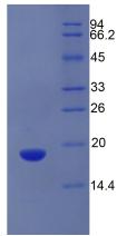 Recombinant Alpha-2-Glycoprotein 1, Zinc Binding (aZGP1)