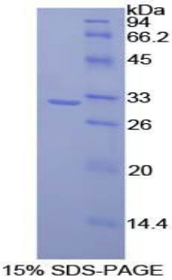 Recombinant CD2 Associated Protein (CD2AP)