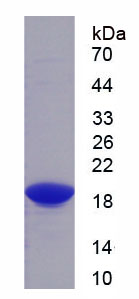 Recombinant Complement Factor H Related Protein 1 (CFHR1)