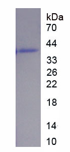 Recombinant Complement Factor H Related Protein 3 (CFHR3)