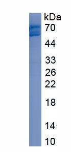 Recombinant DEAD Box Polypeptide 5 (DDX5)