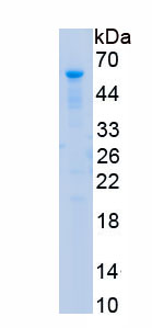 Recombinant Deafness, Autosomal Dominant 5 (DFNA5)