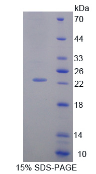 Recombinant Growth Arrest And DNA Damage Inducible Protein Alpha (GADD45a)