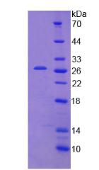 Recombinant Interferon Induced Helicase C Domain Containing Protein 1 (IFIH1)