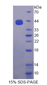 Recombinant Insulin Like Growth Factor 2 mRNA Binding Protein 3 (IGF2BP3)