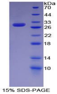 Recombinant KH Domain Containing, RNA Binding, Signal Transduction Associated Protein 1 (KHDRBS1)