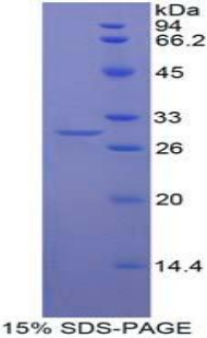 Recombinant Mindbomb Homolog 2 (MIB2)