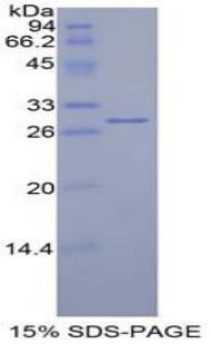 Recombinant Mindbomb Homolog 2 (MIB2)