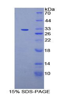 Recombinant Mindbomb Homolog 2 (MIB2)