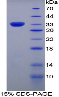 Recombinant Myxovirus Resistance 1 (MX1)